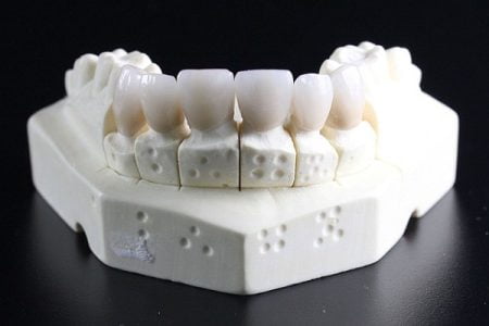 Cerec Crown: The Latest Dental Crown Technology