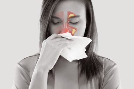 An Overview of Sinusitis or Sinus Infection