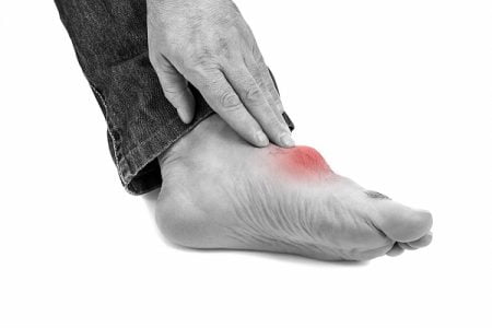 How Long Does Gout Last?