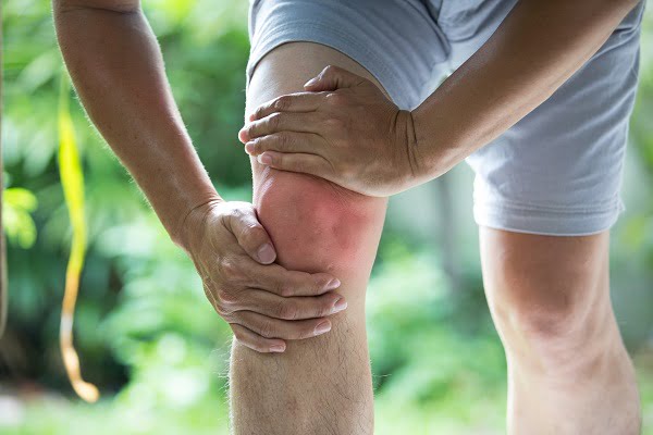 Osteoarthritis Symptoms & Complications