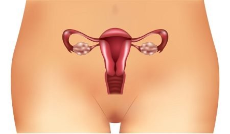 What Are the Signs and Symptoms of PCOS (Polycystic Ovary Syndrome)?