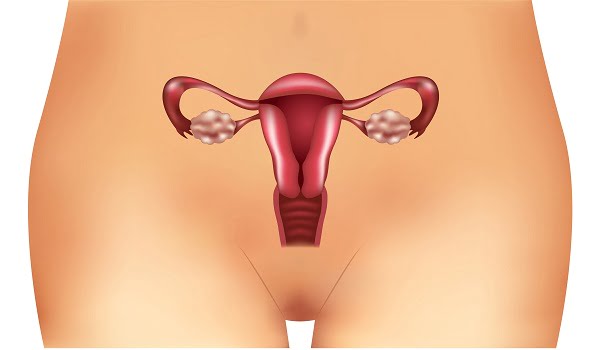 What Are the Signs and Symptoms of PCOS (Polycystic Ovary Syndrome)?