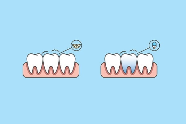 Why Are My Teeth Sensitive All of a Sudden?