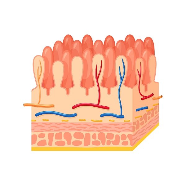 What is Celiac Disease