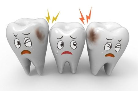 Basics of Dental Caries (Tooth Decay and Dental Cavity)