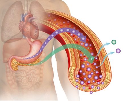 What Are the Causes of Diabetes?