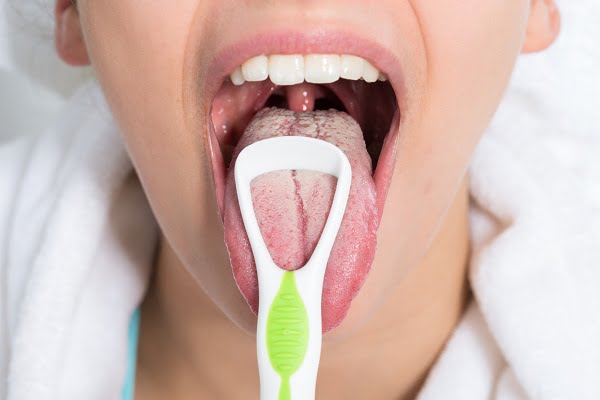 What Are the Signs and Symptoms of Halitosis (Bad Breath)?
