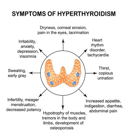 Signs That Indicate You Have Overactive Thyroid - DiseaseFix