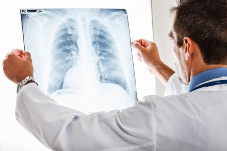 How Do Doctors Diagnose Tuberculosis (TB)?
