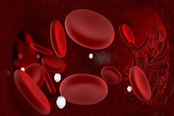 What is VTE (Venous Thromboembolism)?