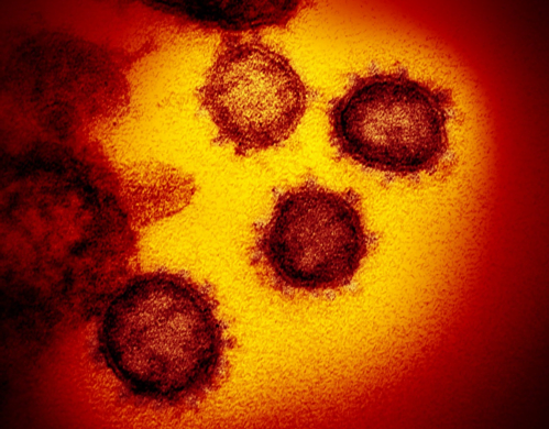 COVID-19 (novel coronavirus) appears on a transmission electron microscope