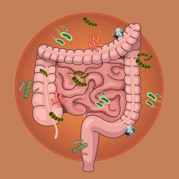 What Are the Causes and Risk Factors of Irritable Bowel Syndrome?