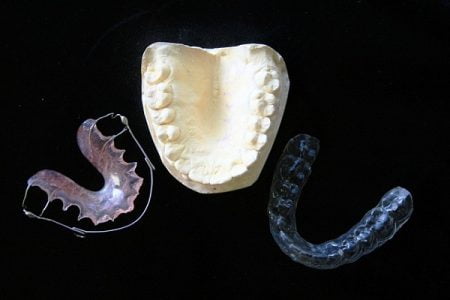 Mouth Guard and its Benefits
