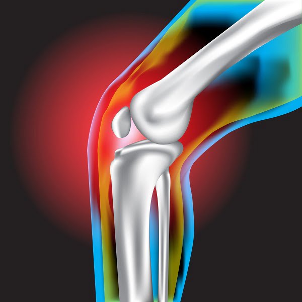 What is Osteoarthritis?