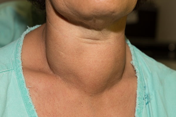 Thyroid Pain: What Does Thyroid Pain Feel Like?