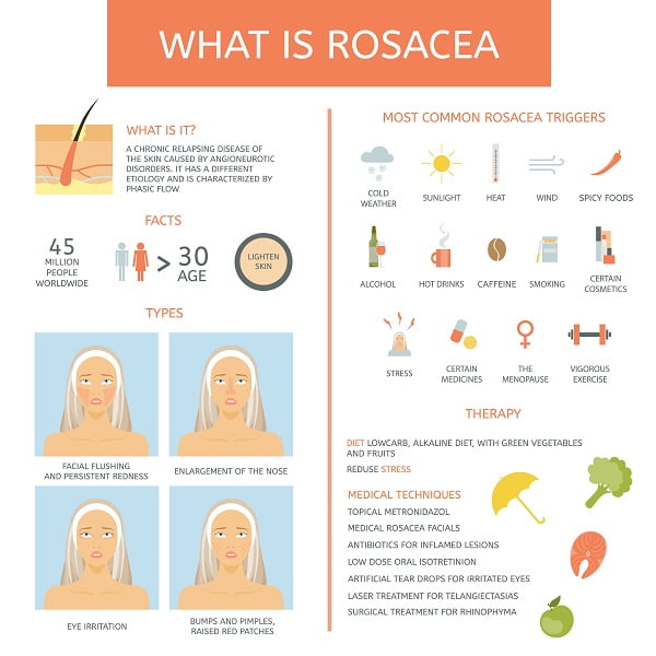 Risk Factors for Rosacea
