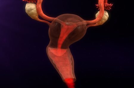 Uterus disease