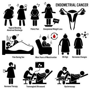 Endometrial cancer overview