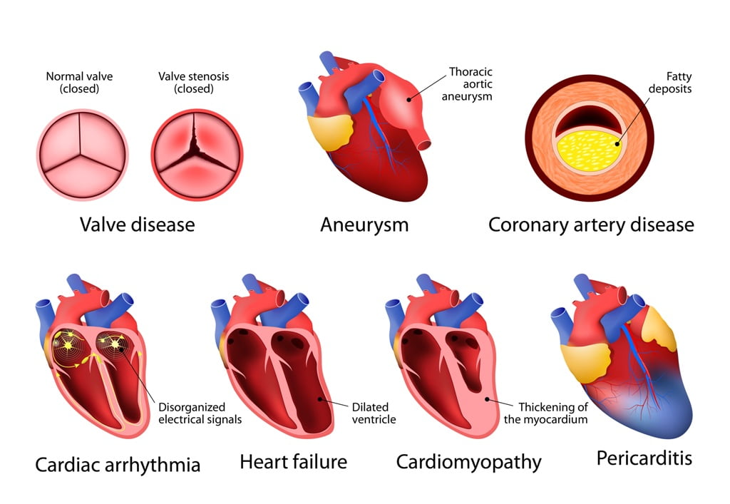 What Are Disease Conditions