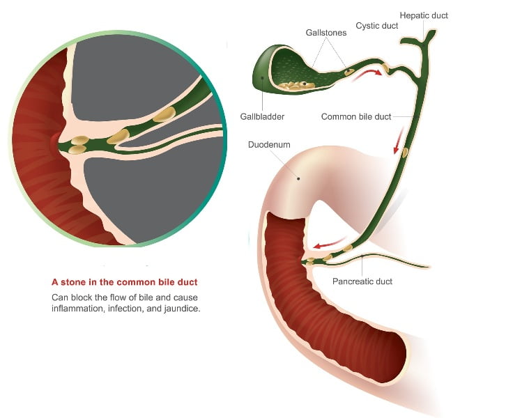 Prevention and Reversing of Macular Degeneration - DiseaseFix