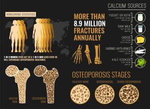 Bone is living tissue, constantly renewing itself