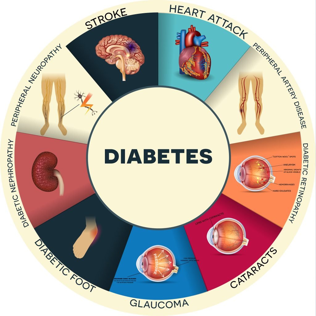 Diabetes-related effect