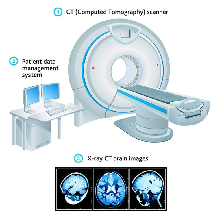 CT scan for brain cancer