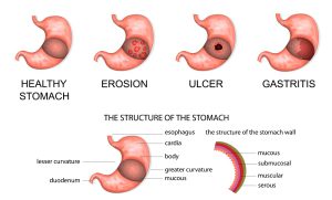 Pathology of the stomach