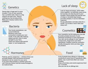 Acne causes