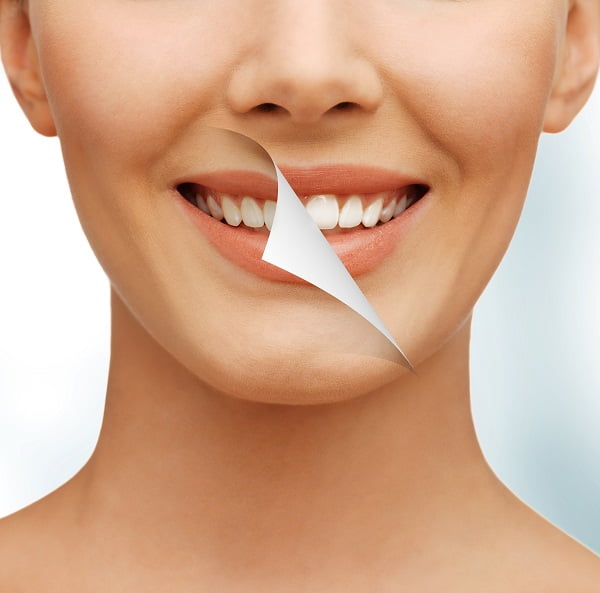 What Can You Do to Prevent Tooth Sensitivity?