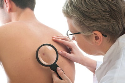 Facts About Skin Cancer