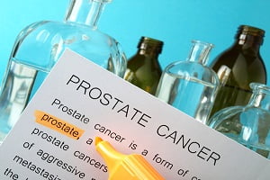 Testing and Diagnosis of Prostate Cancer