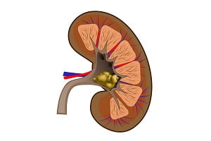 How Are Kidney Stones Formed? Reasons & Types - DiseaseFix