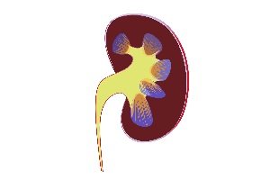 Stages in Diabetic Renal Disease