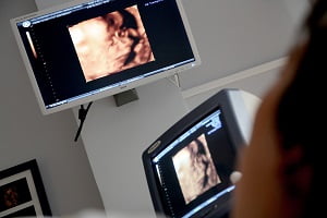 Gallbladder Cancer Ultrasound