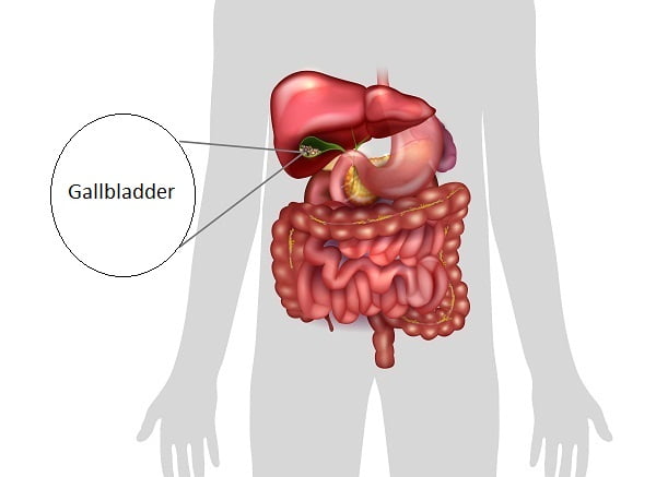 Non-Surgical Ways of Gall Stone Removal