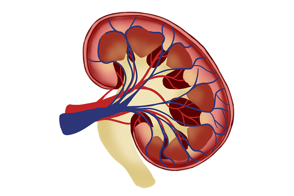 Glomerulonephritis