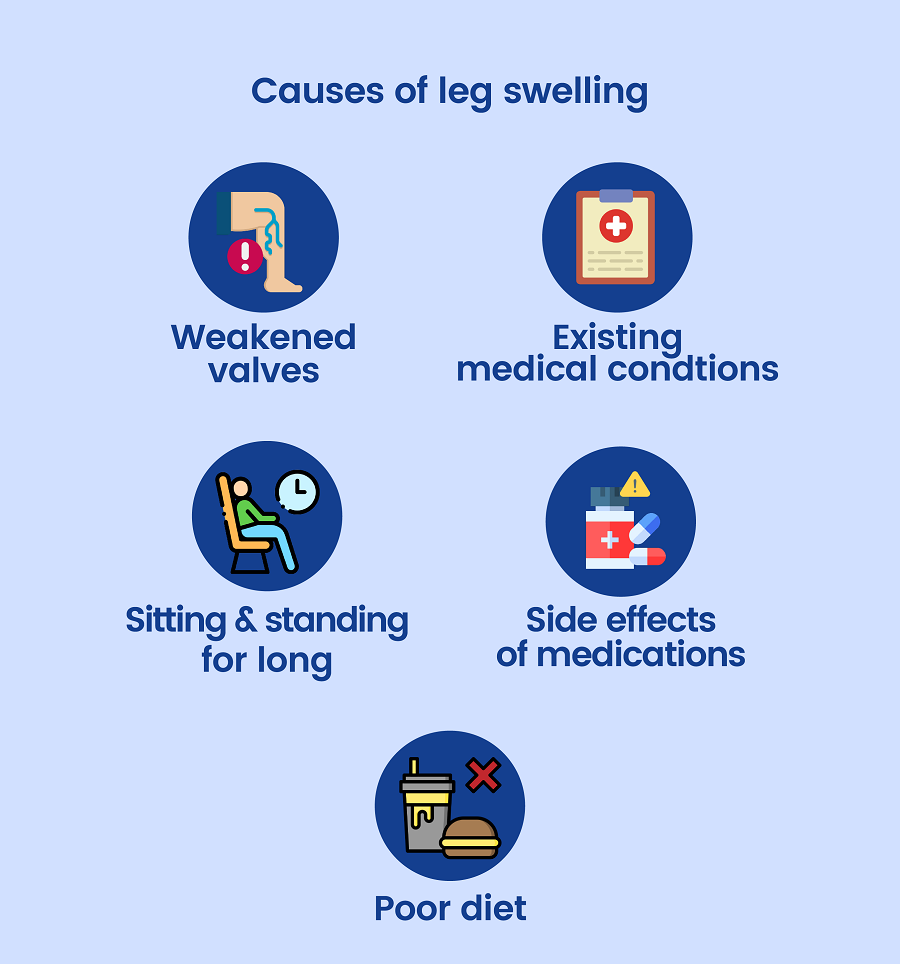 Causes of leg swelling