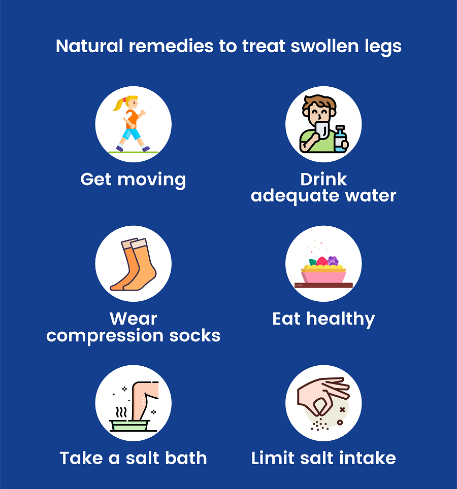 Natural Remedies to treat Swollen Legs
