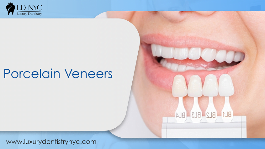 Porcelain Veneers