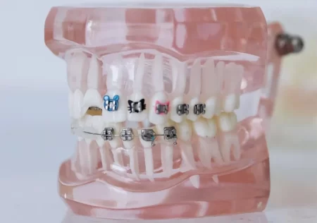 Orthodontic treatments