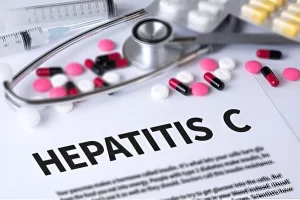 Hepatitis C Treatment