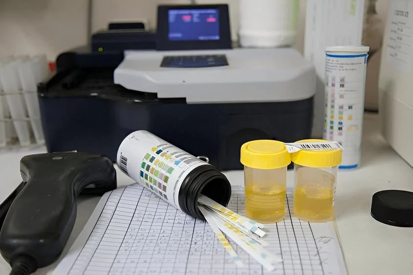 Should Urine Drug Tests