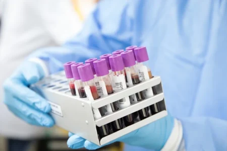 Why Do Labs Take So Much Blood? Can a Single Drop Be Enough? Why Do Labs Take So Much Blood