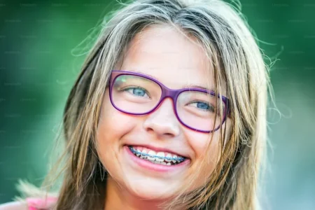 Best Age to Get Braces for Kids in Culver City Best Age to Get Braces for Kids