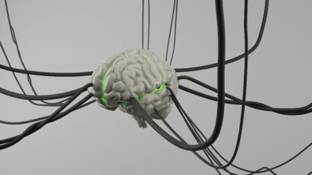 Patient undergoing transcranial magnetic stimulation therapy with device targeting brain regions for depression treatment.