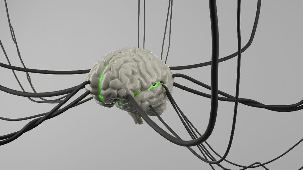 Patient undergoing transcranial magnetic stimulation therapy with device targeting brain regions for depression treatment.