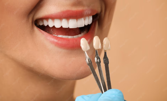 Cosmetic dentist examining porcelain dental veneers and explaining enamel preparation